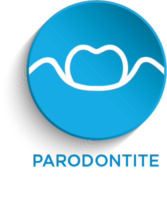 Parodontite